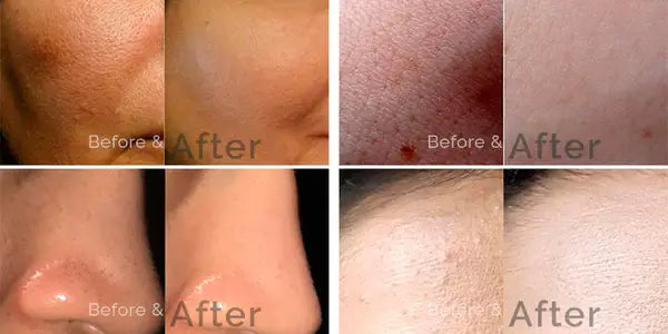 Skin Brightening Serum [ Glutathione 2% Alpha Arbutin 2% Kojic Acid 2% Niacinamide 5% ]