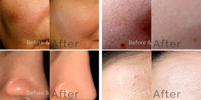 Skin Brightening Serum [ Glutathione 2% Alpha Arbutin 2% Kojic Acid 2% Niacinamide 5% ]